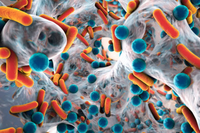 Weltweit sterben mehr Menschen an Infektionen mit antibiotika-resistenten Erregern als an Malaria oder HIV-Infektionen. Das geht aus einem Bericht hervor, für den ein Forschungsteam Daten aus dem Jahr 2019 ausgewertet hat.
