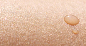 Haut Dermatosen