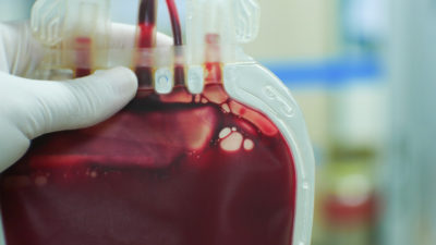 Blutspenden könnten in Zeiten von Corona eine neue Bedeutung bekommen. Genesene mit Antikörpern sind vielleicht eine Hilfe für Schwerkranke. Doch bei Blutspenden gibt es Engpässe. Sollte Solidarität besser vergütet werden als bisher?