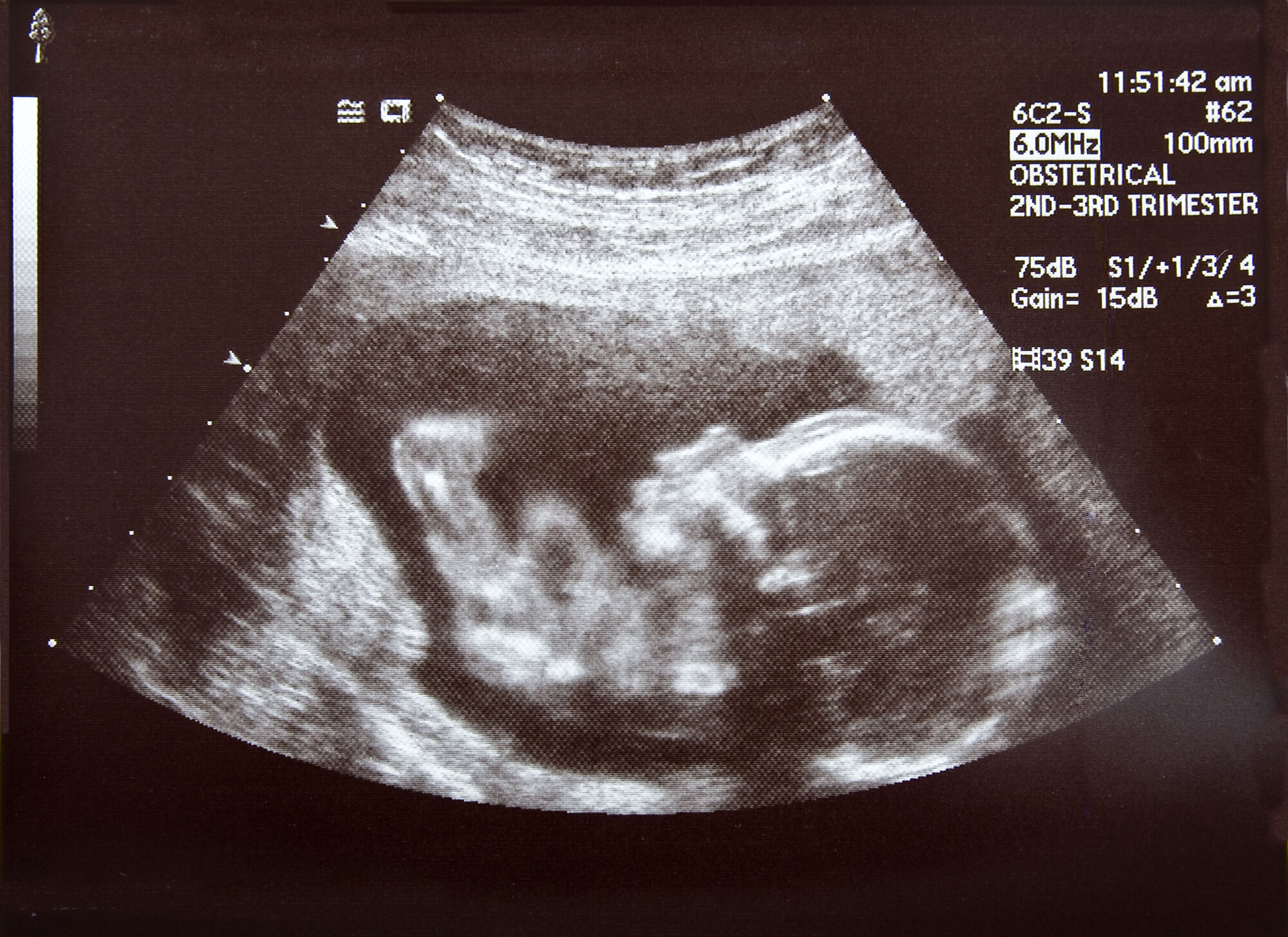 Ultraschall Baby, Schwangerschaft